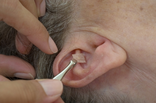 What Are Ear Seeds and What Are They Used For in Detox?